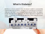 Diabetes - Types, Symptoms, Causes & How To Prevent Diabetes