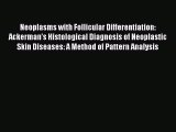 Read Neoplasms with Follicular Differentiation: Ackerman's Histological Diagnosis of Neoplastic