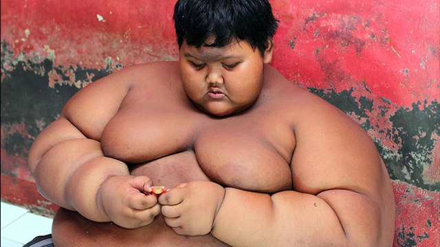 Arya Permana, l'enfant le plus gros du monde en 2016