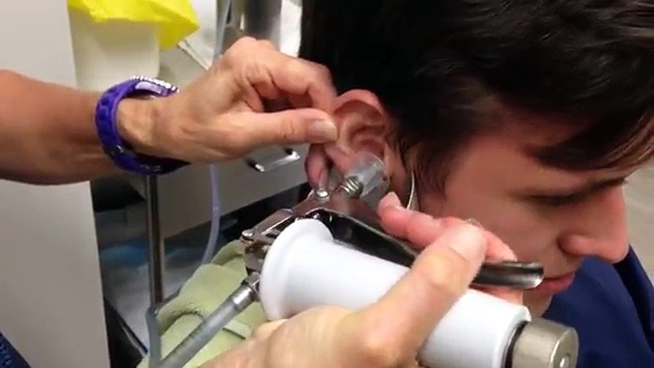 Ear Wax Irrigation DISGUSTING..