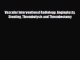 Read Vascular Interventional Radiology: Angioplasty Stenting Thrombolysis and Thrombectomy