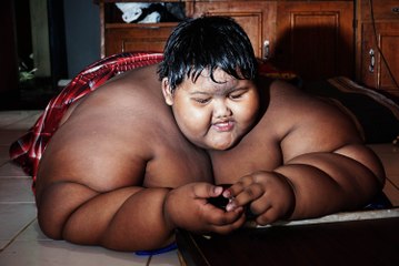 423lb Ten-Year-Old Has Life Threatening Obesity