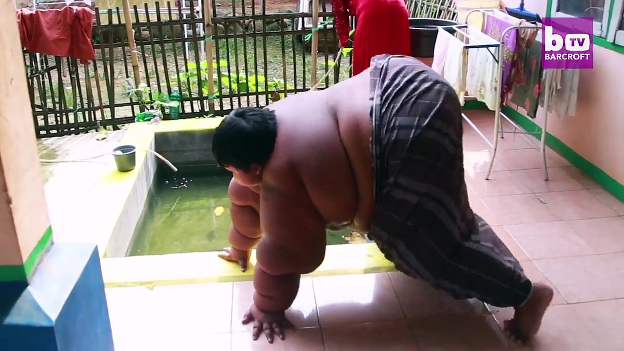 Ce pauvre petit garçon pèse 192 kilos à seulement 10 ans... Sa famille lance un appel au secours !