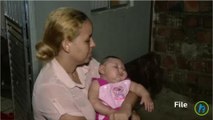 First Zika-related birth defect microcephaly born in Florida