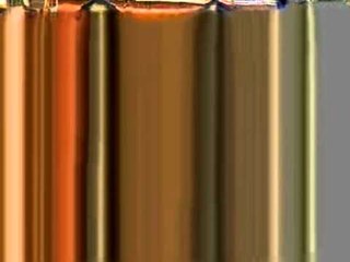 Show cause to doctors of SSKM Hospital in 'sweeper-stitching' incident