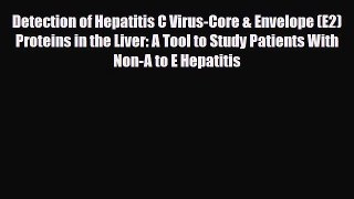 Read Detection of Hepatitis C Virus-Core & Envelope (E2) Proteins in the Liver: A Tool to Study