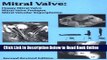 Read Mitral Valve: Floppy Mitral Valve, Mitral Valve Prolapse, Mitral Valvular Regurgitation