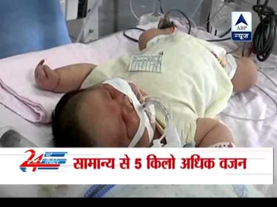 Woman delivers boy weighting 7.1 kilograms in China