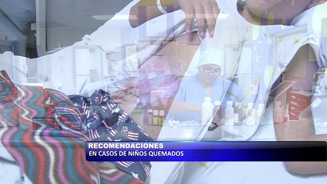 Importantes recomendaciones si su niño ha sufrido quemaduras