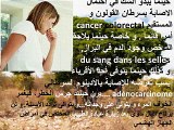 Cancer colorectal et tests de recherche de sang occulte dans les selles -  سرطان القولون و المستيم