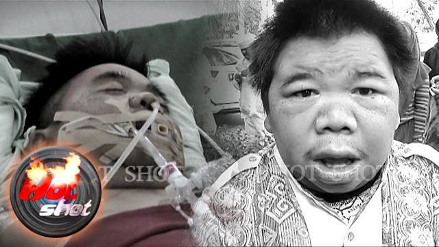Hendrik Ceper Meninggal Dunia Pasca Koma - Hot Shot 03 Juli 2016