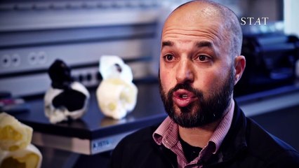 Quand les infirmières voient la tête de ce nouveau-né, c'est la panique! Elles n'ont jamais vu ça!