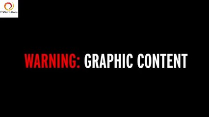 On dirait simplement une maman qui allaite son petit, mais quand j'ai vu sa jambe, WOW!