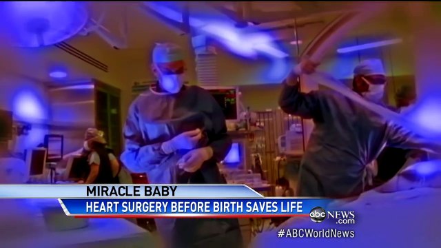 La maman accouche de ce bébé d'une drôle de couleur... mais quand elle l'entend faire ce son? Elle n'arrive pas y croire