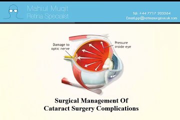 Cataract Surgery By Private Practice of Mr Mahi Muqit PhD FRCOphth