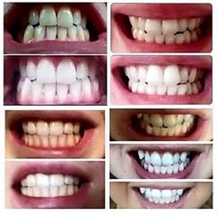 AP24 Whitening Toothpaste