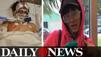 Texas Teen Could Be Blind After A Homemade ‘Sparkler Bomb’ Explodes