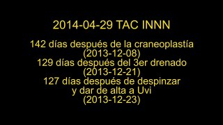 2014-04-29 TAC INNN