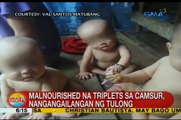Malnourished triplets in Camarines Norte receive help after video goes viral