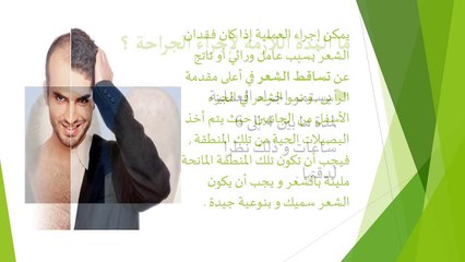 زراعة الشعر وكل ما تريد معرفتة من التكلفة وافضل المراكز