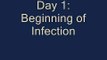 The Infection: (28 Days Later Parody)