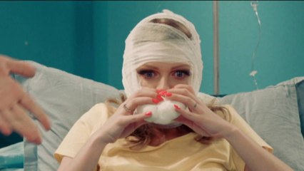 Последствия увеличения губ )) Готовьтесь посмеяться от души!