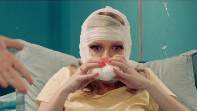 Последствия увеличения губ )) Готовьтесь посмеяться от души!