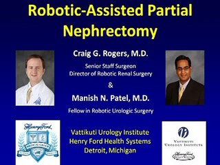 Robotic Partial Nephrectomy - Step 1: Patient Information and Operative Setup