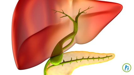 What are Gallstones?