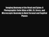 Download Imaging Anatomy of the Head and Spine: A Photographic Color Atlas of Mri Ct Gross