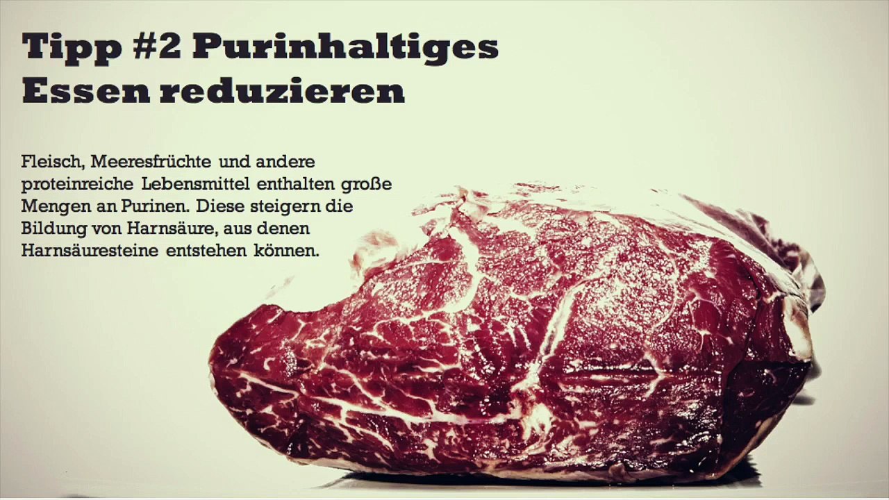 Nierensteine entfernen