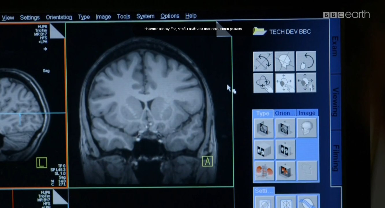 BBC horizon Какого пола твой мозг? / Is Your Brain Male Or Female? (2014) HD1080p