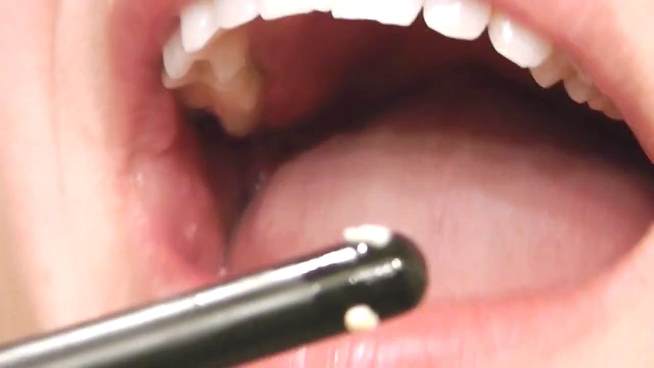 Dacă ai probleme cu RESPIRAȚIA aceasta este problema despre care nu știe mai nimeni. URMĂREȘTE cu atenție videoclipul!