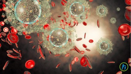 What is AIDS (acquired immune deficiency syndrome)?