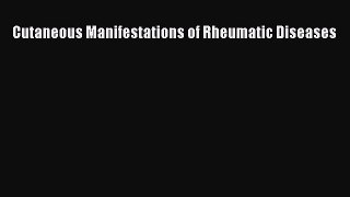 Read Cutaneous Manifestations of Rheumatic Diseases Ebook Free