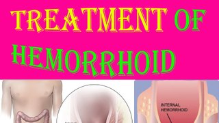 how to get rid of hemorrhoids in 2016