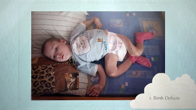 Benefits of Folic Acid Vitamins