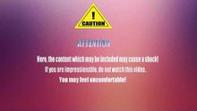 Sebaceous cyst. Removal cysts on head. Cyst - All pimples channel