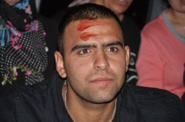 Terör Saldırısından Kurtulan Askerin Ailesi Oğulları İçin Kurban Kesti