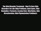 Read The Skin Disorder Treatment - How To Cure Skin Disorders For Life (Skin Problems Dark