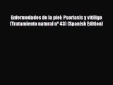 Read Enfermedades de la piel: Psoriasis y vitíligo (Tratamiento natural nº 43) (Spanish Edition)