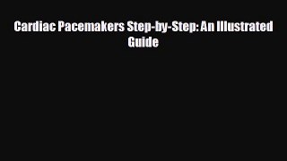 Download Cardiac Pacemakers Step-by-Step: An Illustrated Guide PDF Online