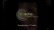 3D - 4D Echo 17 weken