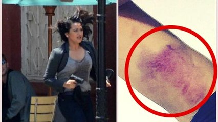 OMG ! Sonakshi Sinha BADLY INJURED | Akira Movie 2016