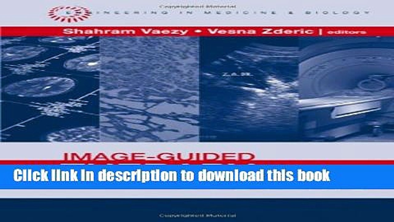 Read Image-guided Therapy Systems (Engineering in Medicine   Biology)  Ebook Free