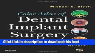 Read Color Atlas of Dental Implant Surgery, 3e  Ebook Free