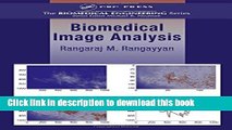 Read Biomedical Image Analysis (Biomedical Engineering)  Ebook Free