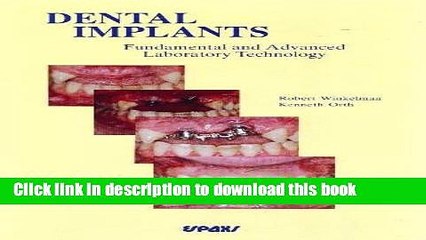 Download Dental Implants: Fundamental and Advanced Laboratory Technology PDF Online