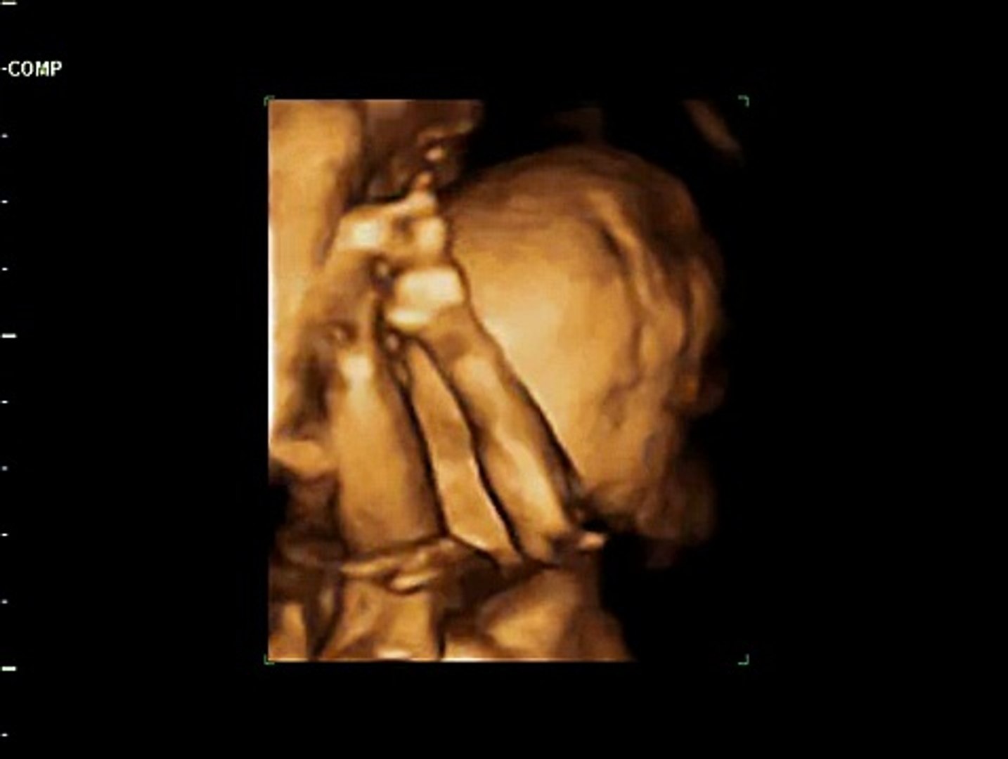 3d Ultrasound Weeks Pregnant Video Dailymotion