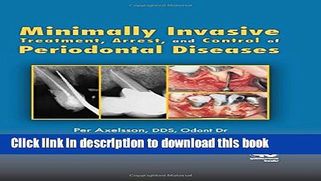 Read Minimally Invasive Treatment, Arrest, and Control of Periodontal Diseases (The Axelsson